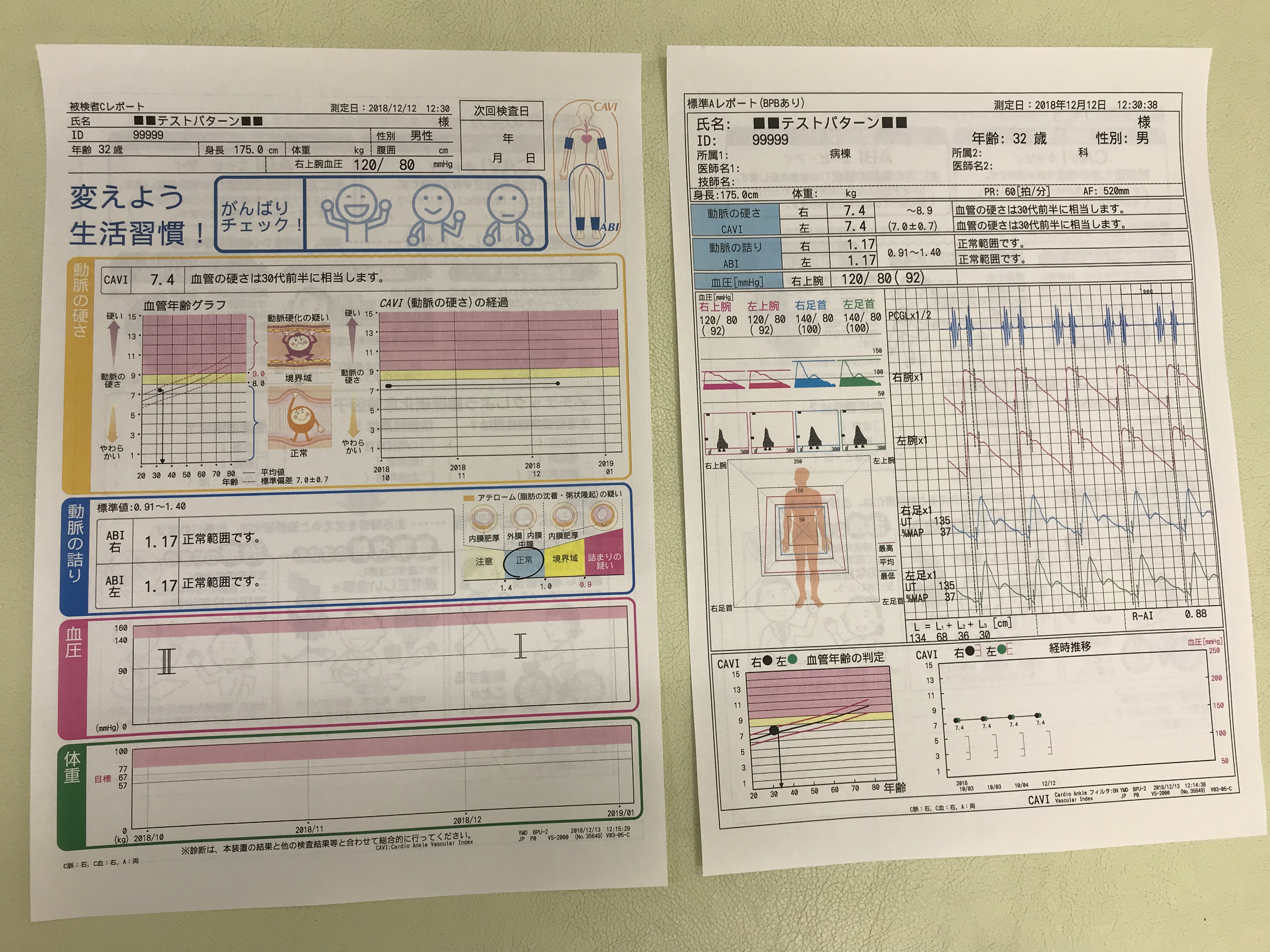 血管年齢の最新検査機器を更新しました。|お知らせ | 滝川市 血管年齢の最新検査機器を更新しました。|お知らせ | 滝川市